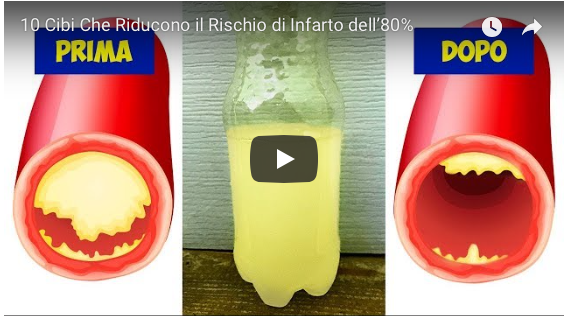 10 Cibi Che Riducono Il Rischio Di Infarto Dell80 Servi Della Croce